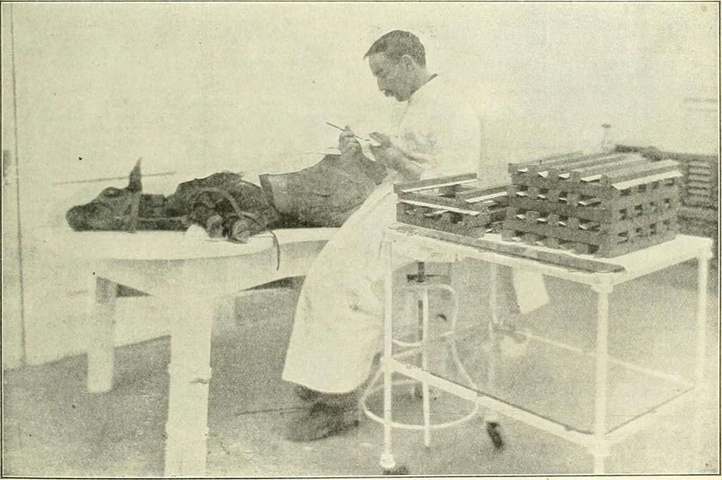 Tuberculosis
